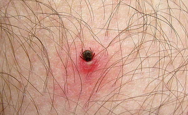 Harapáskor a parazita jelentős mélységig bemerítheti a fejét a bőrbe.