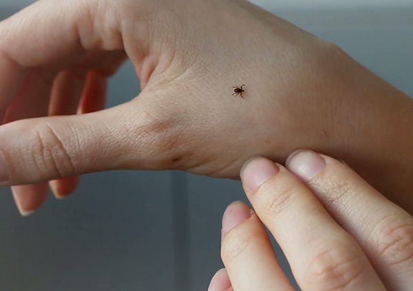 Chúng tôi tìm hiểu cách bạn có thể tự bảo vệ mình hiệu quả khỏi vết cắn của bọ ve trong tự nhiên ...
