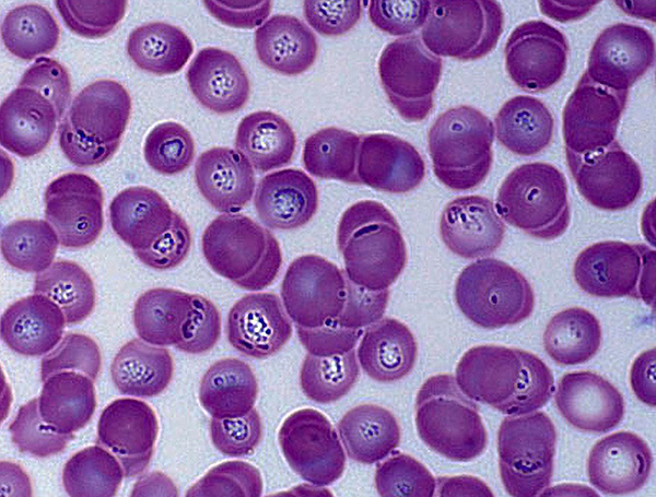 Takto vypadá krev psa s piroplazmózou pod mikroskopem – piroplazmy jsou jasně viditelné v červených krvinkách.