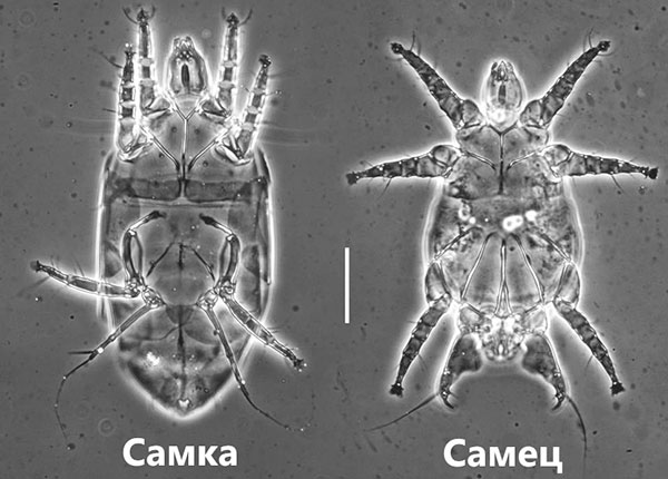 Roztoč jahodový pod mikroskopem (samice a samec)
