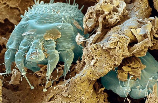 Šugava grinja pod mikroskopom