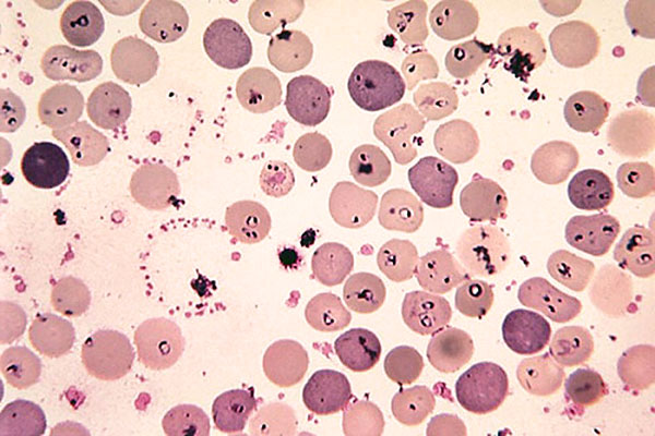 Piroplasmos i blodet